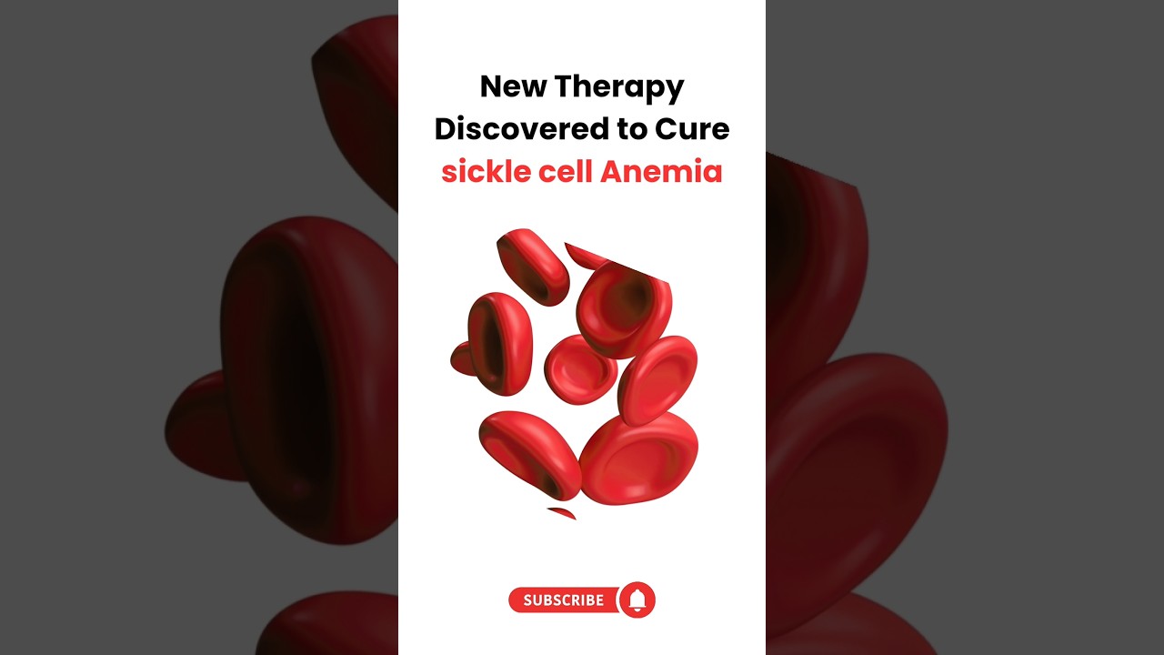 Sickle Cell Anemia Patients: What the Latest U.S. Research Means for a Cure