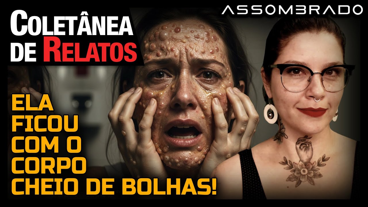 LIGA&Ccedil;&Atilde;O DO AL&Eacute;M, LOBISOMEM, HOMEM ANIMALESCO, CORPO CHEIO DE BOLHAS E MUITO MAIS- COLET&Acirc;NEA