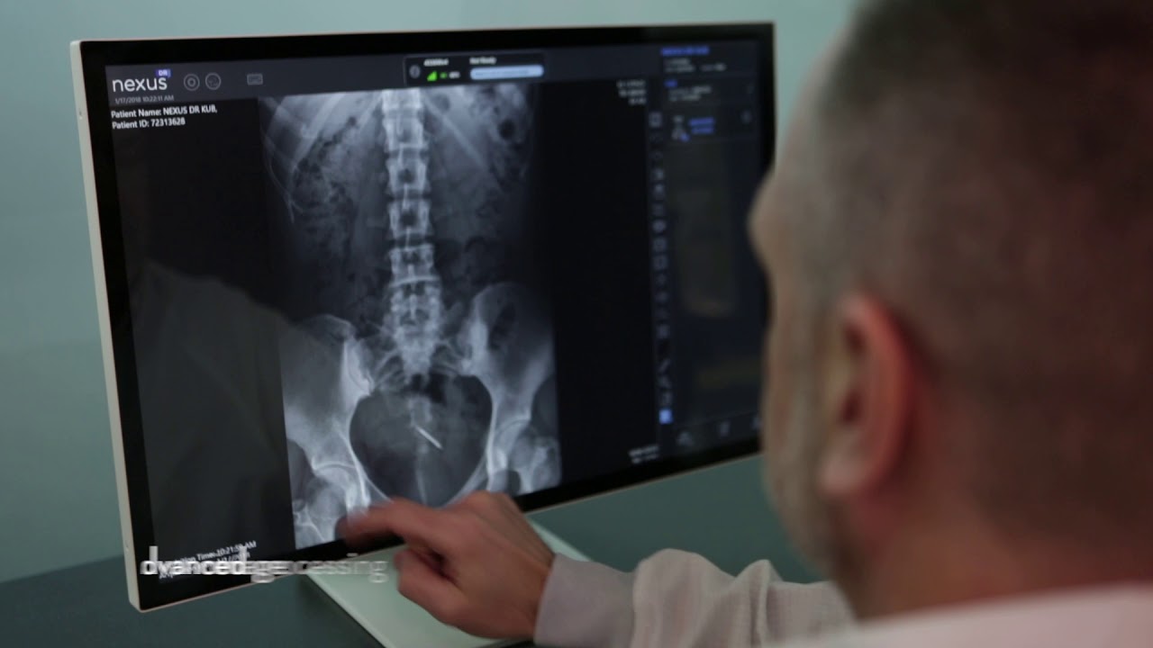 Varex Imaging Nexus DR Software