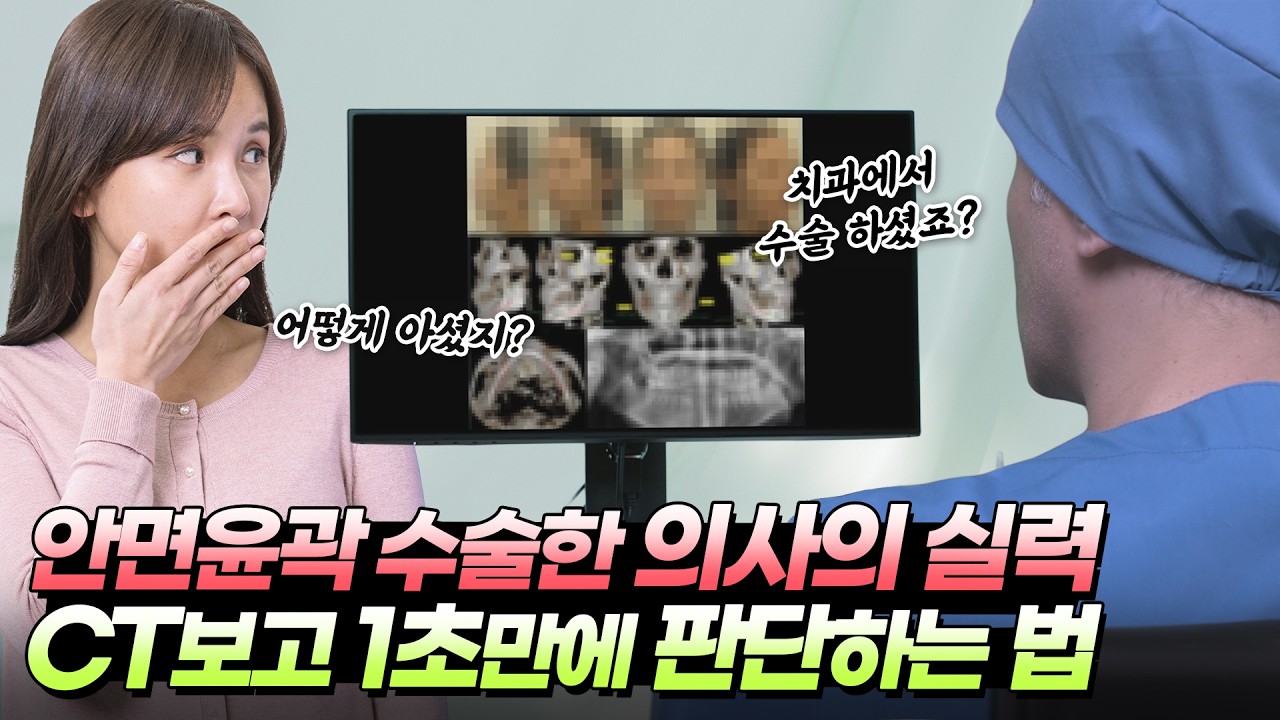안면윤곽 성형외과 의사 실력 CT만 보고 1초만에 아는 방법 #안면윤곽 #성형외과 #성형외과의사 #안면윤곽수술