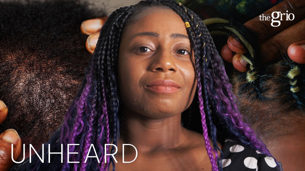 Black Women & Alopecia: The Stigma of Hair Loss | UNHEARD