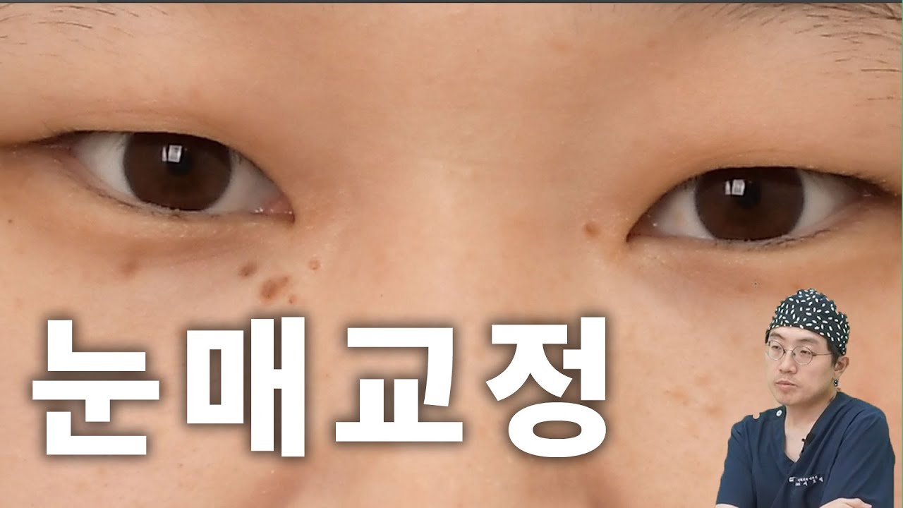 편집자도 이거 보고 눈매교정 안 하기로 했습니다..