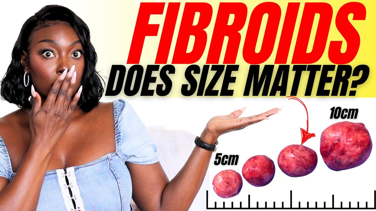 Your Fibroids are not small! The Truth About Size & Symptoms