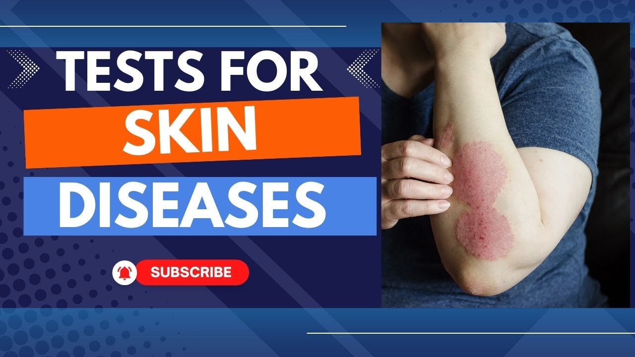 Blood test for skin diseases | Blood tests for skin problems