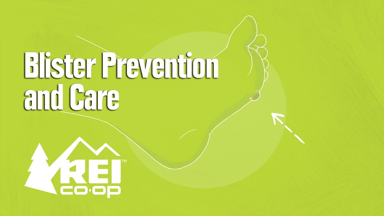 How to Prevent BLISTERS-- and CARE for them