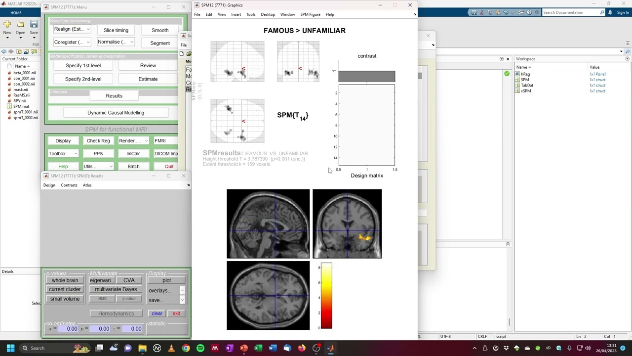 fMRI Analysis with SPM: Second Level Analysis (with GUI)