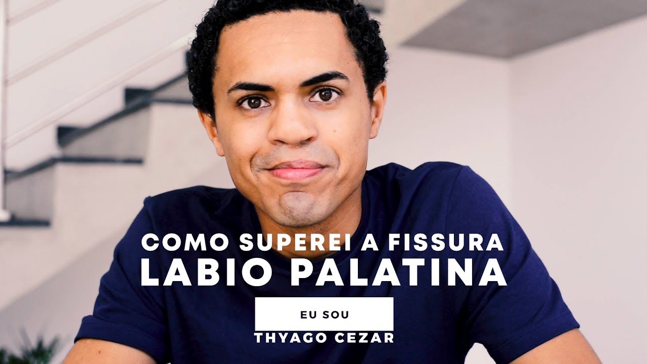 Thyago Cezar - Como Superei a Fissura Lábio Palatina