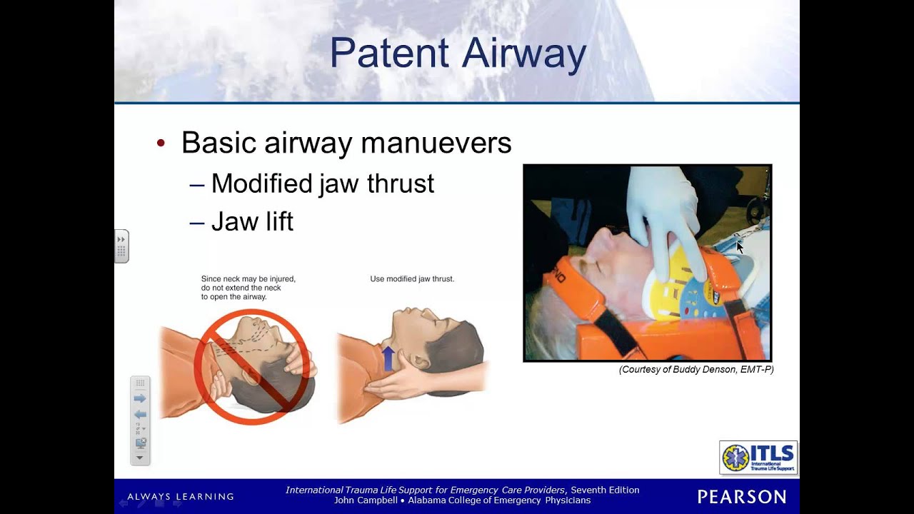 ITLS Chapter 4 Airway