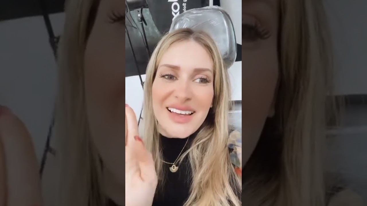 حصريا.لايف كنزة مرسلي من عيادة تجميل الأسنان و النتيجة مفاجأة ♥️.