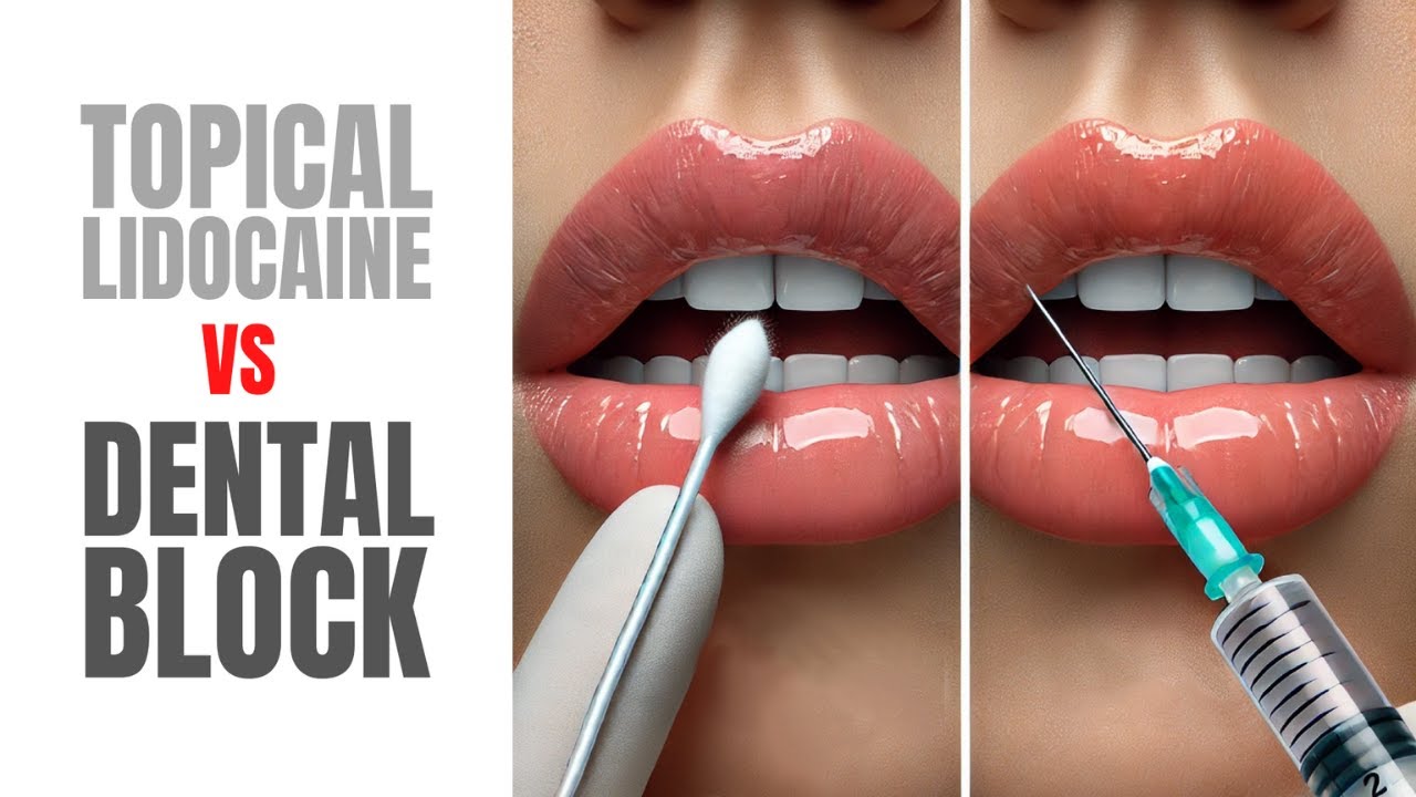 Dental Block or Numbing Cream For Lip Fillers? Here's What's Best | Mabrie Facial Institute