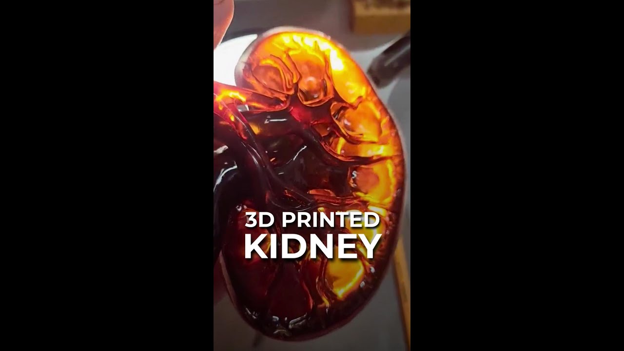 This Kidney Was 3D Printed