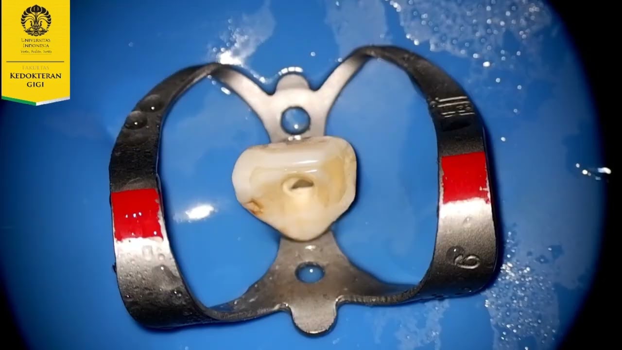 AKSES ENDODONTIK - SKILLS LAB IKGK S1 FKGUI