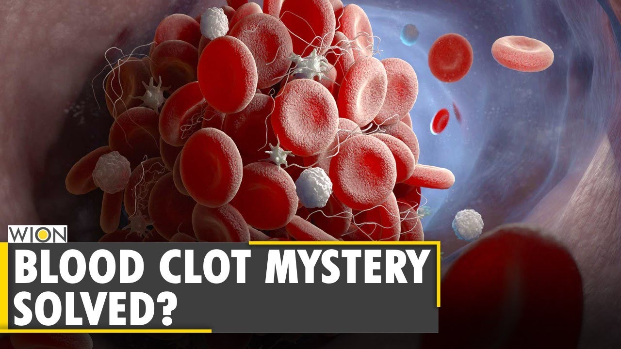 Vaccines may be revamped to avoid blood clots, German scientists claim | COVID-19 | Coronavirus