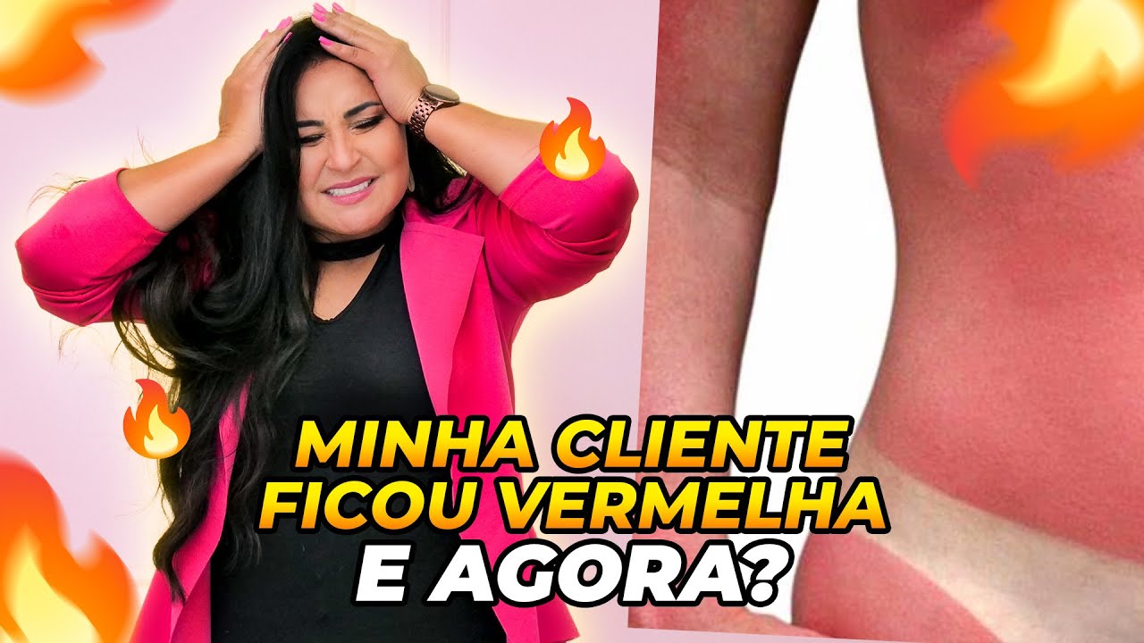 MINHA CLIENTE FICOU VERMELHA, E AGORA - CUIDADOS APÓS O BRONZE - GI OLIVEIRA BRONZE
