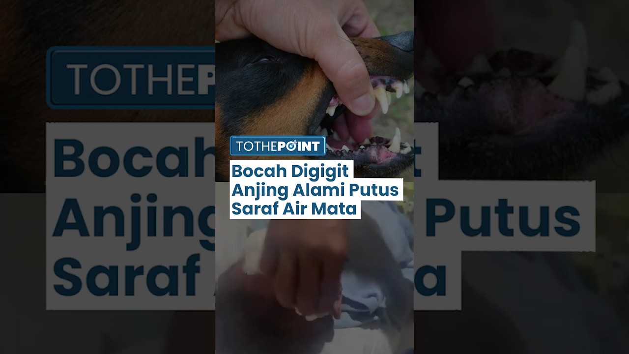 VIRAL Bocah Digigit Anjing Tetangga Alami Putus Saraf Air Mata, Pemilik Anjing Siap Tanggung Jawab
