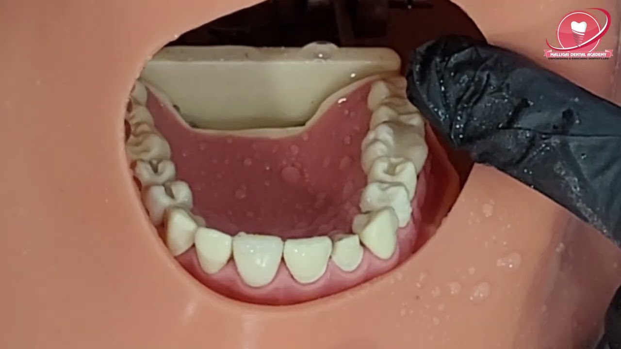 LDS 3 Exam Part 3 Manikin Preps Demo of 16 Cusp Buildup by Major Dr Pravin Prathip #LDSPART3MANIKIN