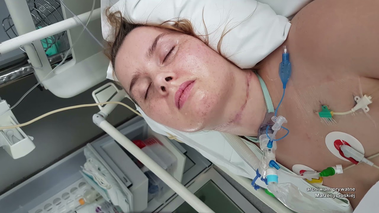 Mąż poderżnął jej gardło. Przeżyła, ale nie rusza się. Po policzkach płyną jej łzy (UWAGA! TVN)