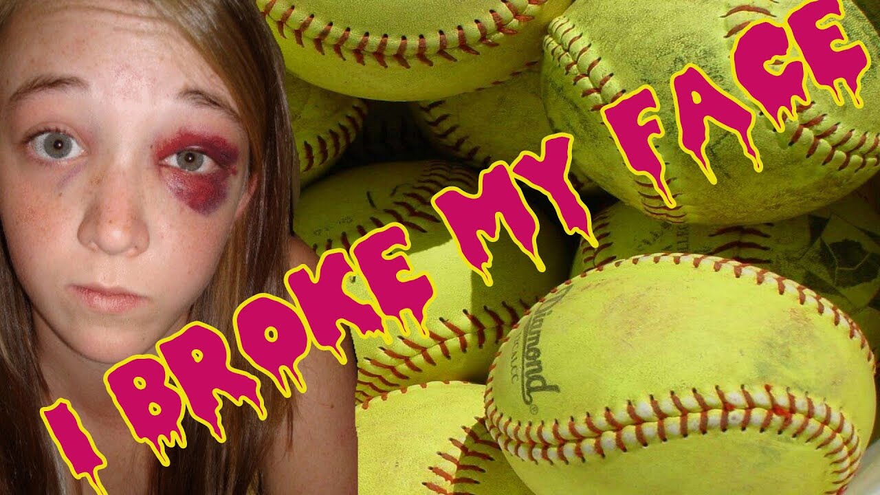 PLASTIC SURGERY// I BROKE MY FACE | Meghan McCarthy