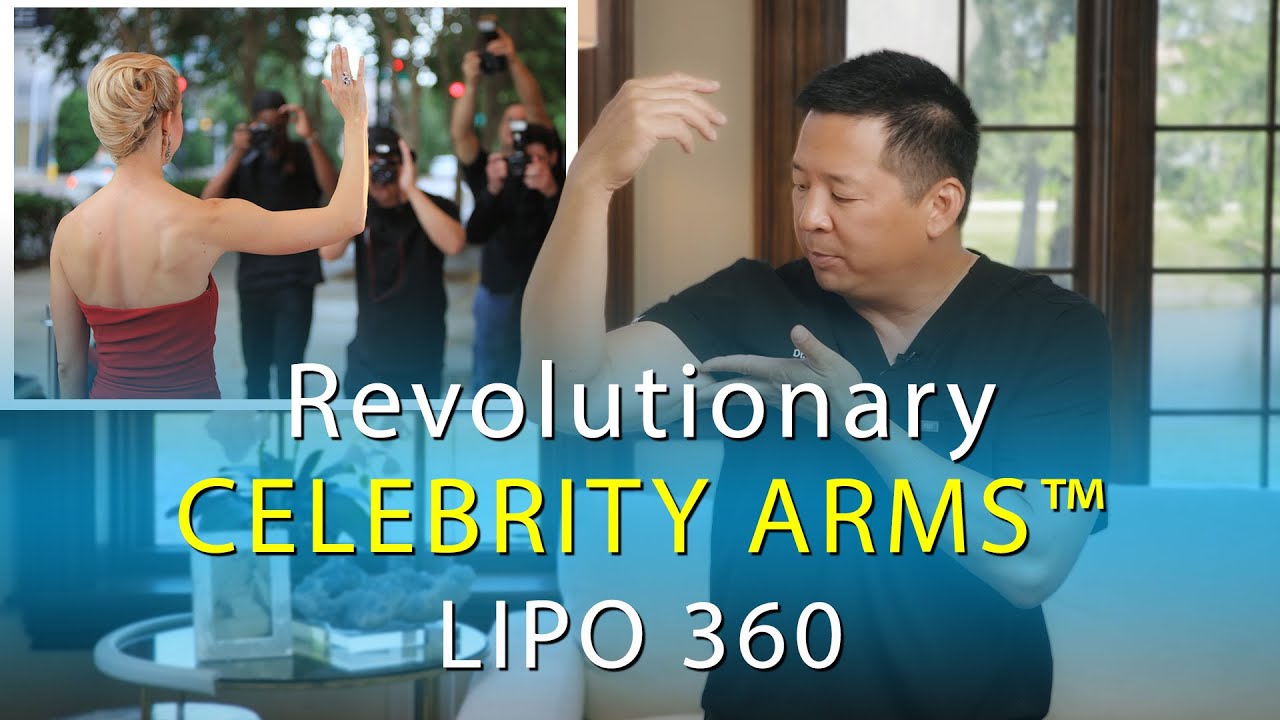 Arm Liposuction | Lipo 360 Arms | Revolutionary Celebrity Arms&trade; | High-Definition | Expert Dr. Su