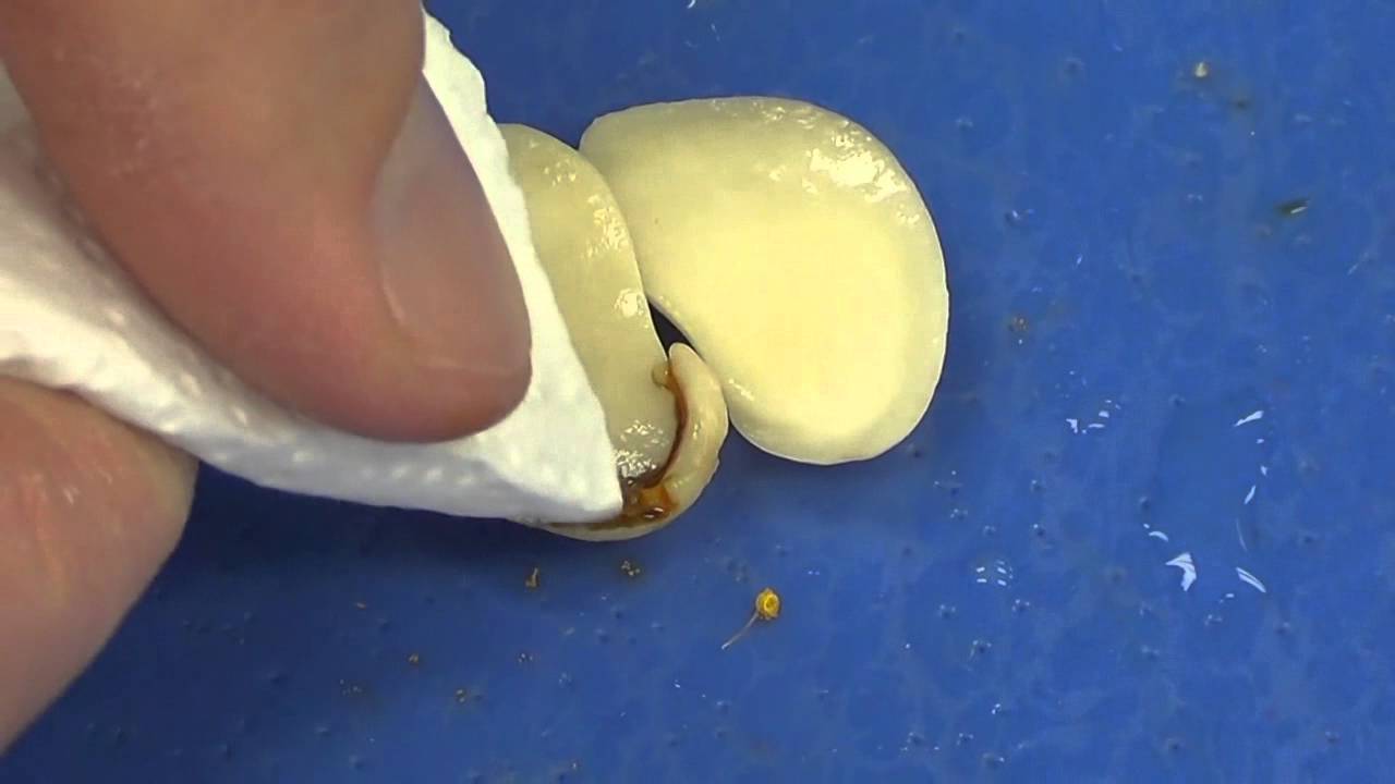 Parts of a Seed 2_Dissection