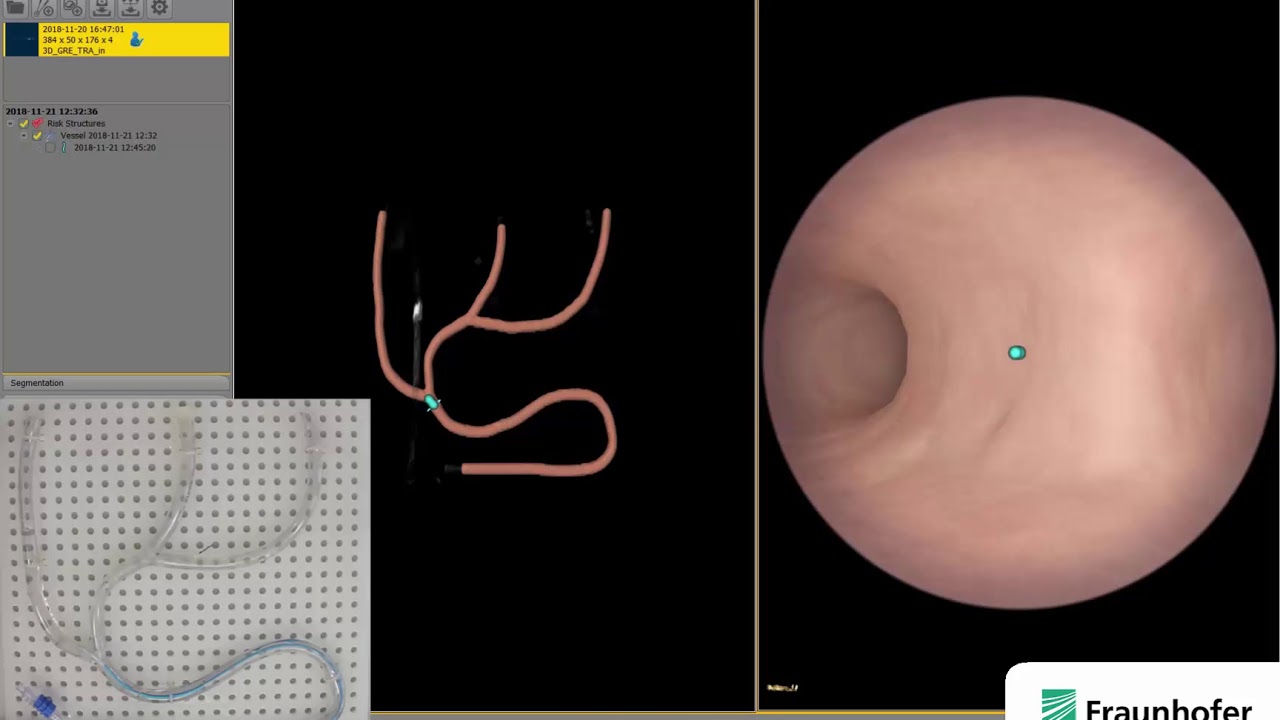 Precise Navigation Through the Vascular System