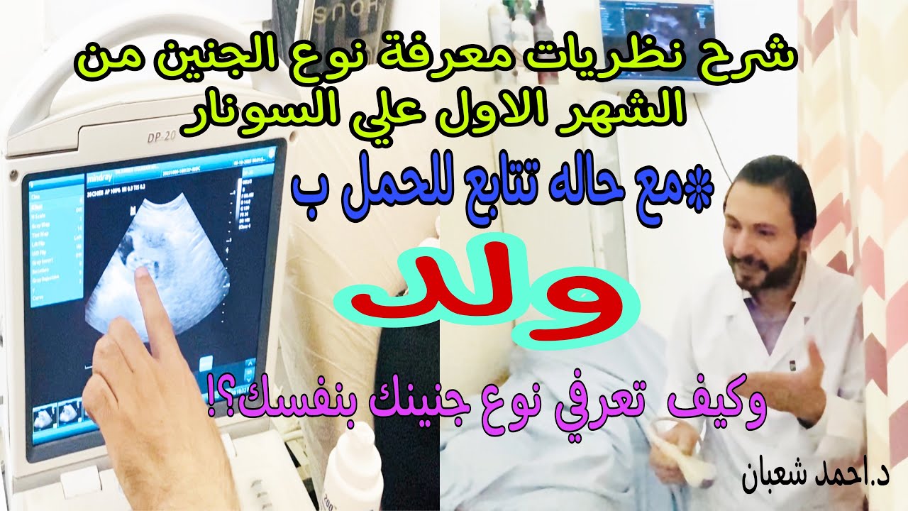 نظريات معرفة نوع الجنين من الشهر الاول بالسونار | مع حاله تتابع للحمل ب