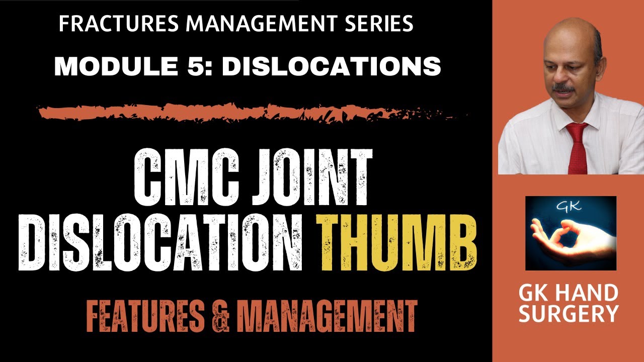 Thumb carpometacarpal joint dislocation (CMC joint) - Features and management