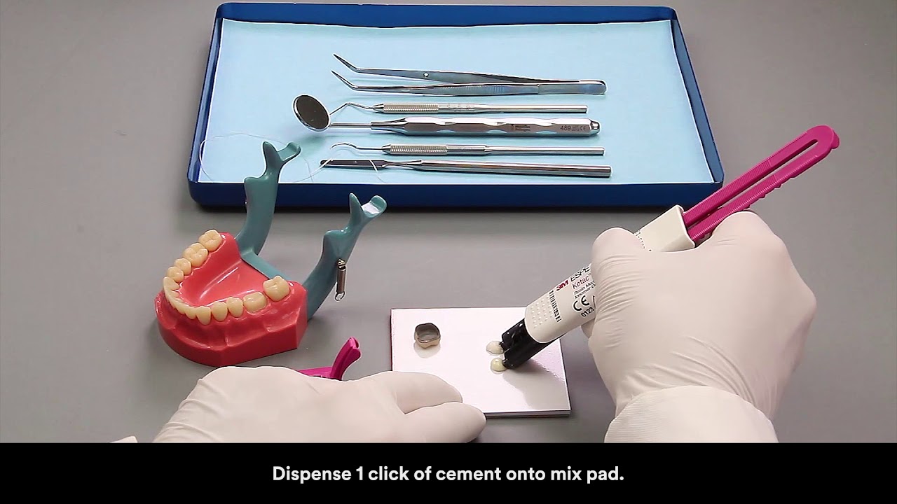 3M RelyX Luting Plus clicker cementation PFM crown
