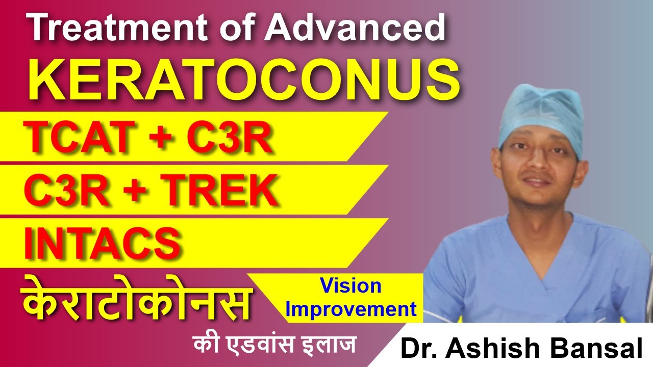 Advanced Keratoconus Treatment C3R Plus- TCAT with C3R TREK INTACS | Keratoconus Surgery