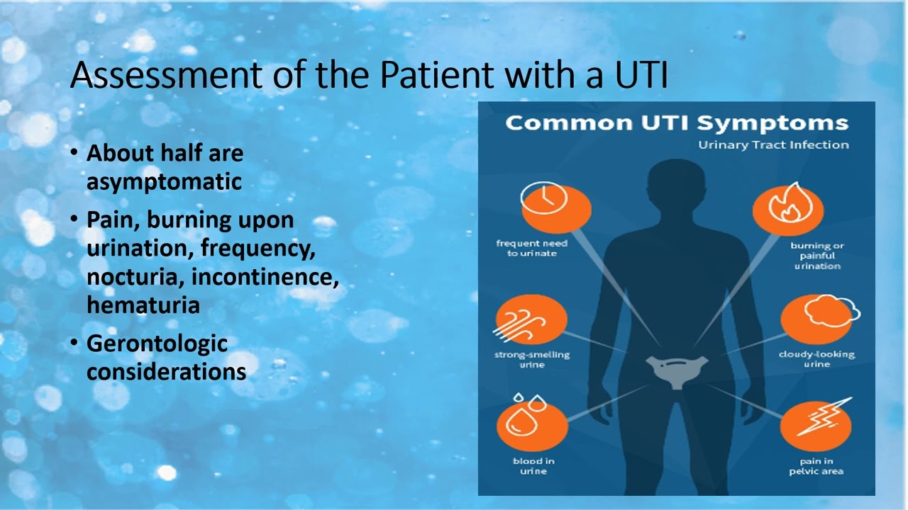 UTI VIDEO