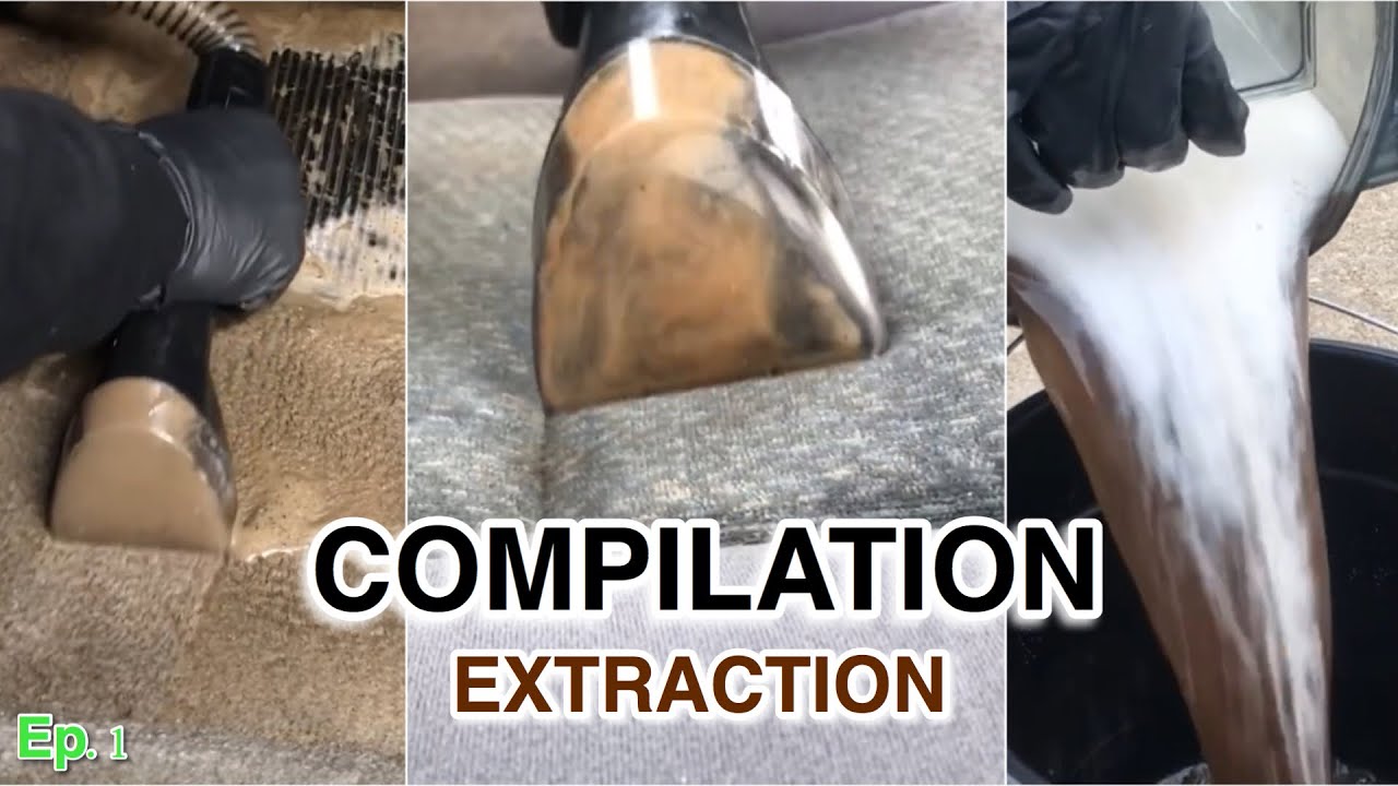11 Minutes of Pure Extraction Satisfaction | The Nastiest EVER!