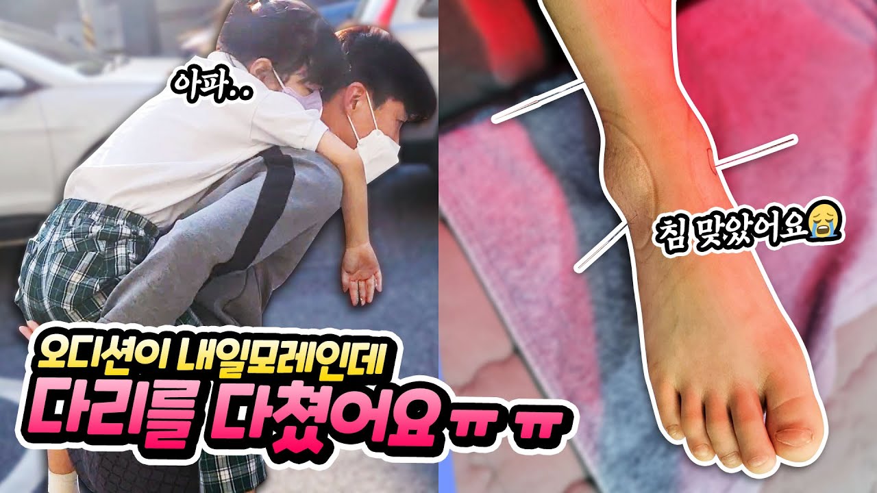 오디션이 내일모레인데 다리를 다쳤어요 ㅠㅠ 유니는 오디션을 무사히 마칠 수 있을까요 ?? 별난가족 일상 브이로그 유니의 성장 스토리 byulnan family