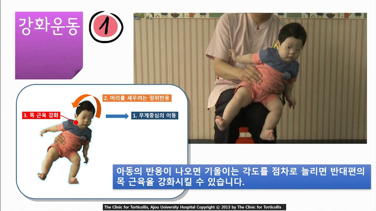 측경의 물리치료 - 아주대학교병원 사경치료클리닉 교육Ⅰ