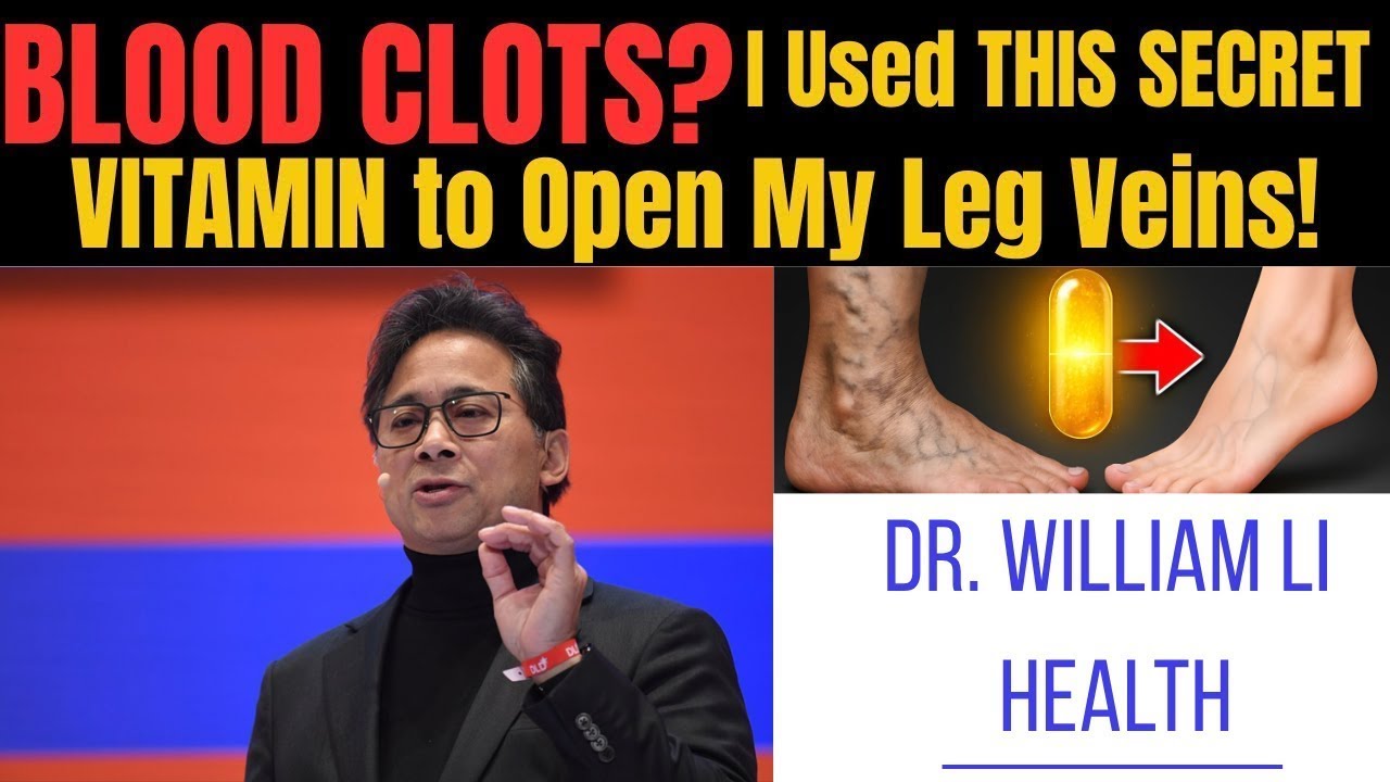 This Vitamin Dissolves Blood Clots in Your Legs &ndash; Seniors Over 60 Must Watch! Dr  William Li health