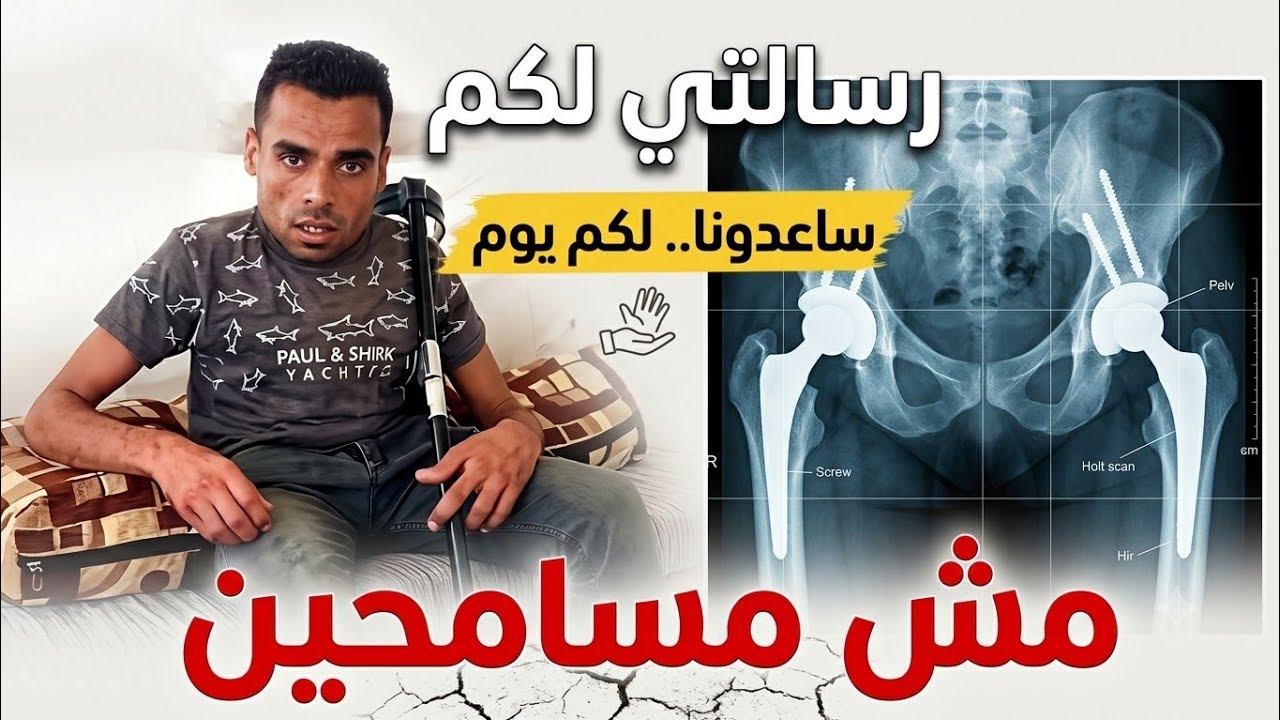 لا تتجاهل هذا الفيديو لو عندك قلب 💔 .. إنسان يُصارع المرض وحيداً #gaza #اكسبلور