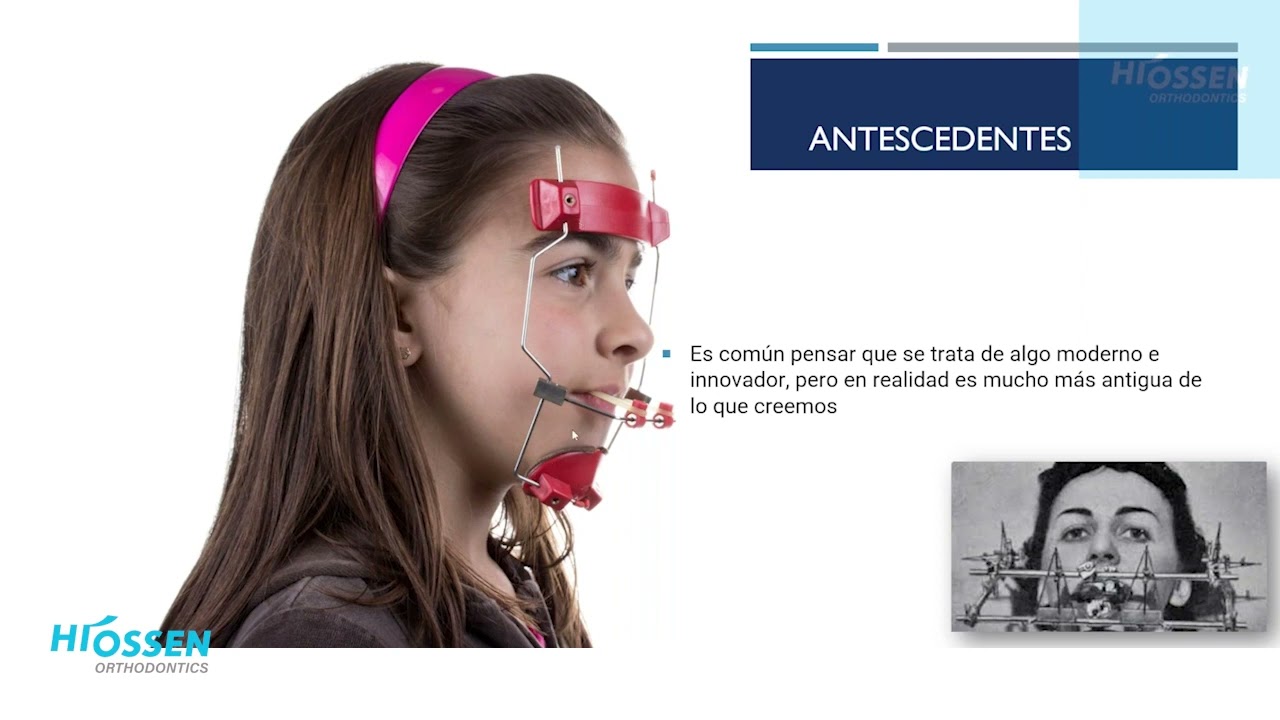 Webinar sobre Aparatología y Alternativas en Ortodoncia impartida por el Dr. Mario Gutiérrez