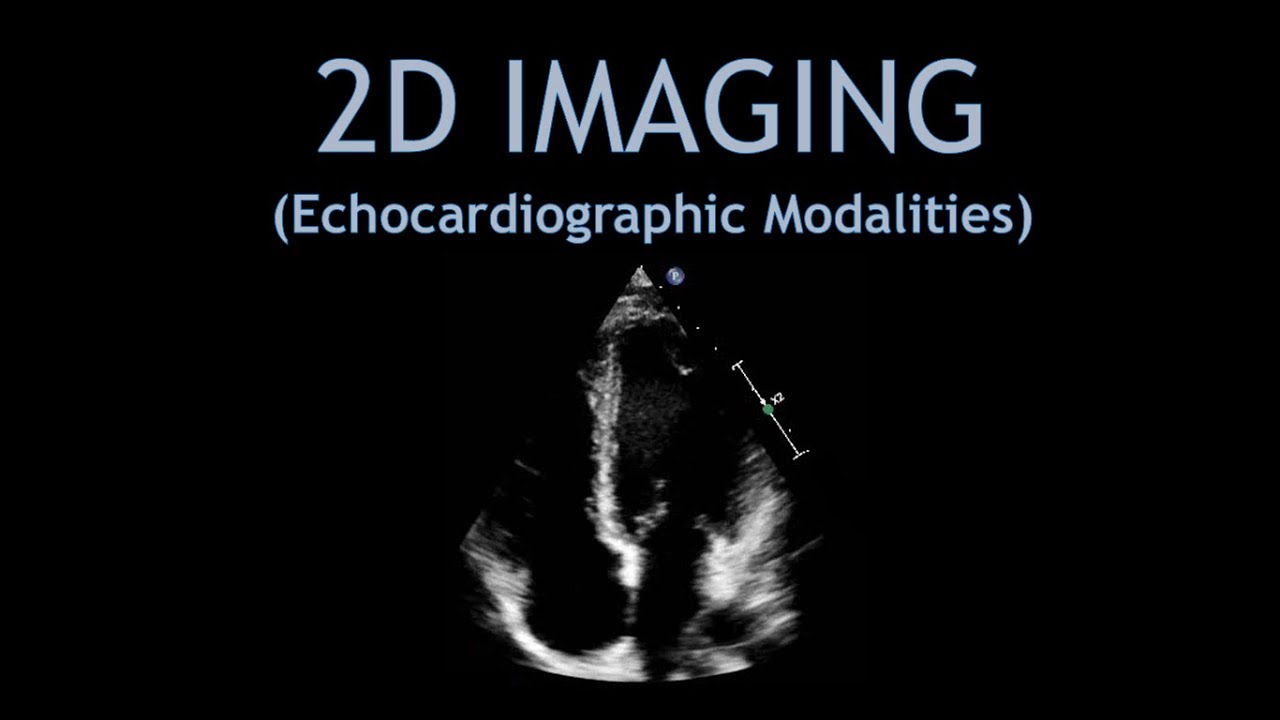 2D IMAGING + Image optimisation! (Echocardiogram).
