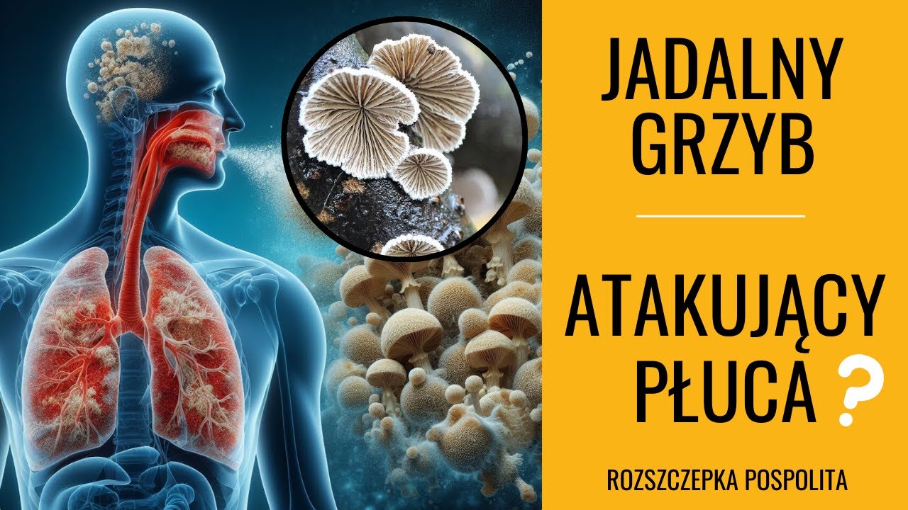 Grzyby atakujące ludzkie płuca? Rozszczepka pospolita