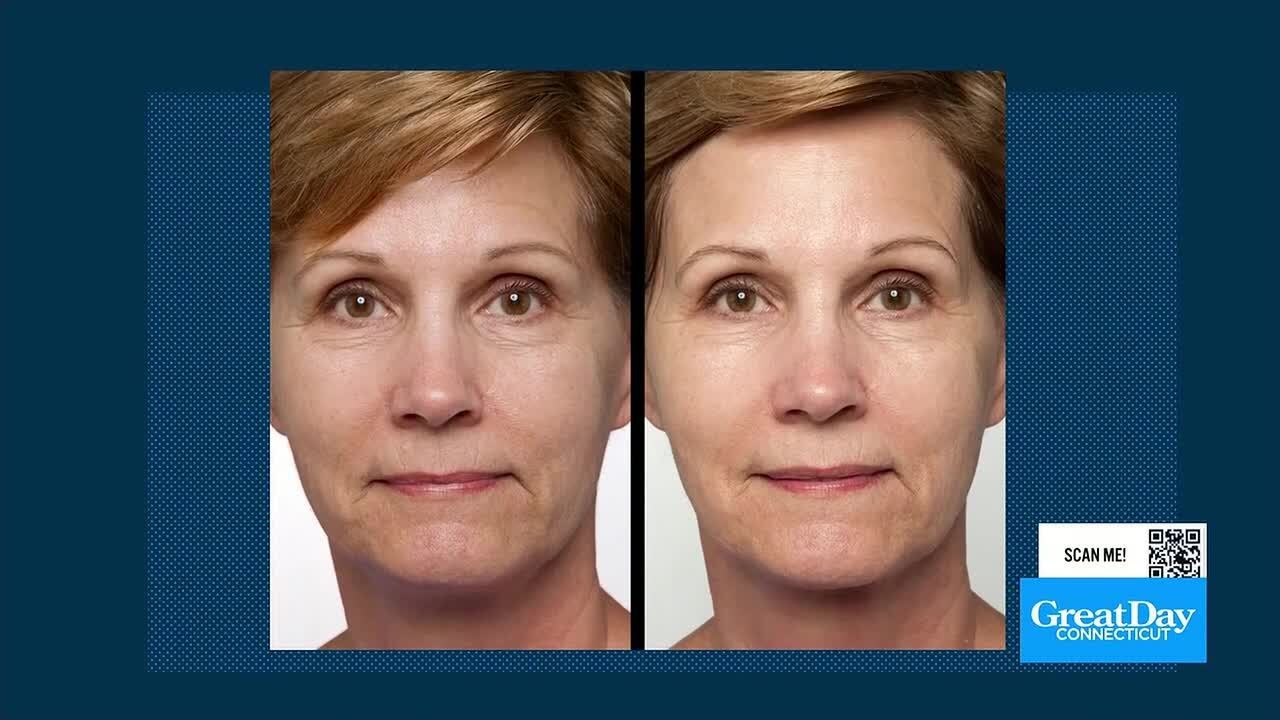 Ice Elements Two Minute Miracle Gel for winter skin