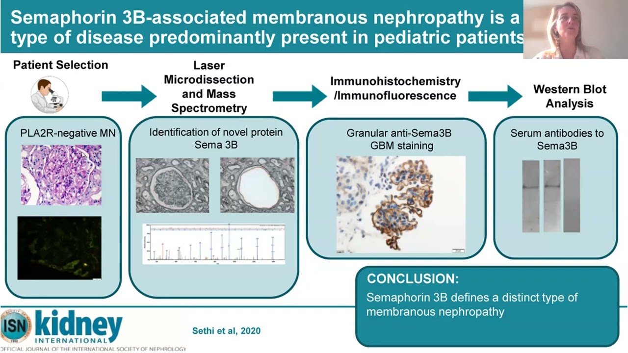 Immunopathologie et Traitement des Glomérulonéphrites Extra Membraneuses