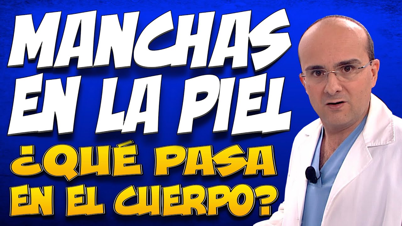MANCHAS EN LA PIEL - &iquest;Qu&eacute; pasa dentro del cuerpo de las personas que las padecen?