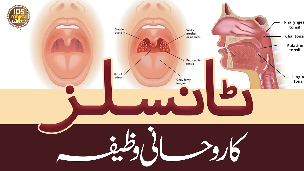 Tonsils Ka Rohani Wazifa | Tonsils Treatment | Mufti Ghulam Dastageer