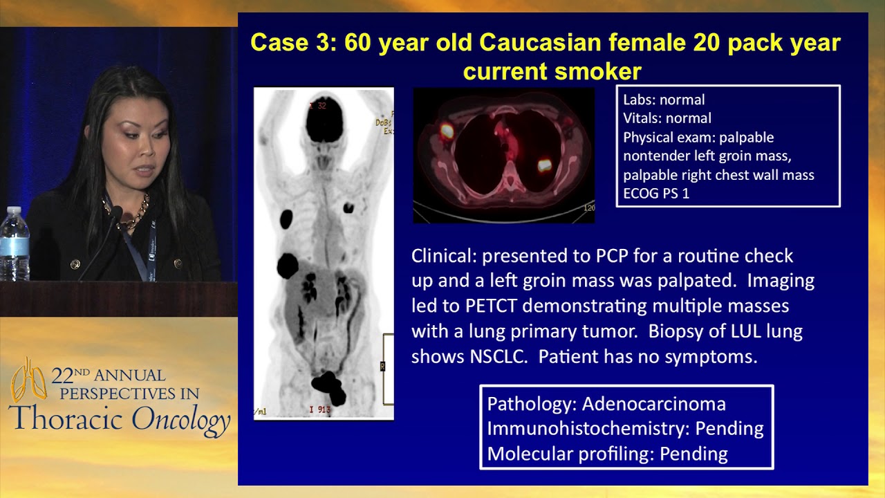 Managing inevitable delays in tissue testing results: When to wait; when to intervene