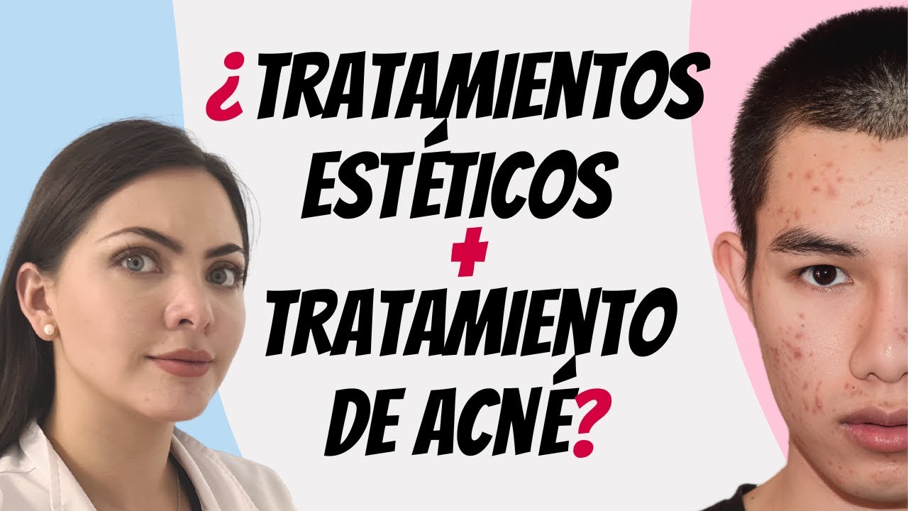 Lo que nadie te dice sobre la Isotretinoína y los tratamientos de belleza