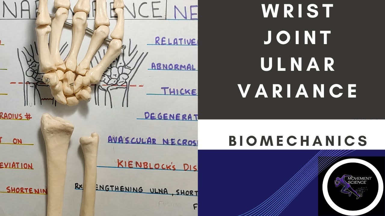 ULNAR VARIANCE ( WRIST JOINT COMPLEX BIOMECHANICS) Physiotherapy Tutorials