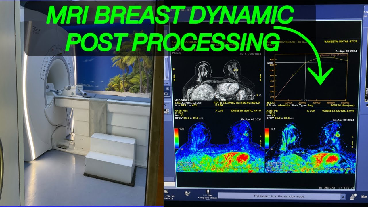 MRI BREAST POST PROCESSING step by step #Mri Breast post processing GE machine #Mri ReadyView