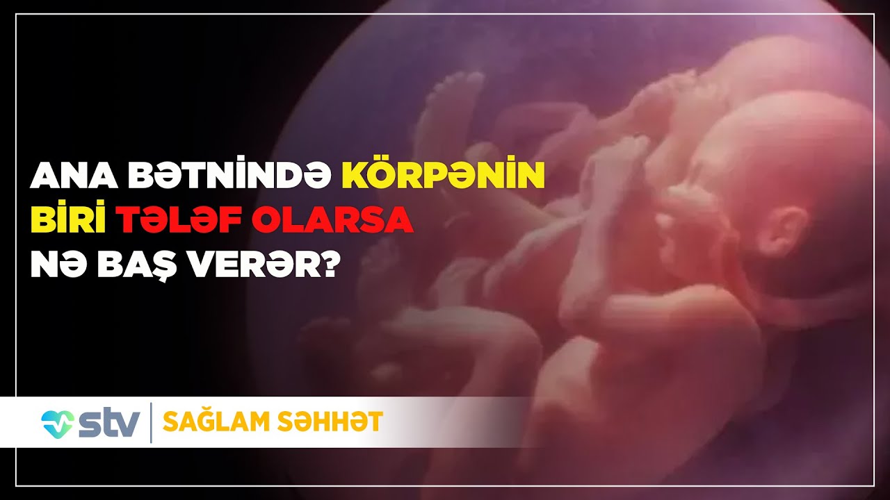 Əkizlərin biri ana bətnində tələf olarsa digər körpəyə hansı təsiri olar? - (07.03.2025)