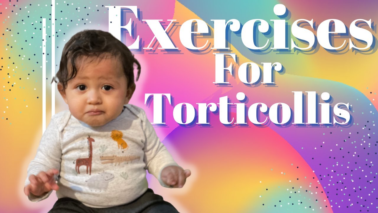 Exercises for Torticollis/ Stretches for torticollis// Baby with Right tightness.