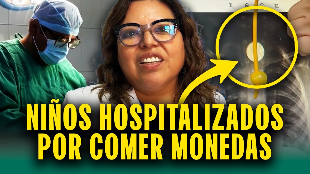 Aumentan casos de niños internados por comer monedas y plásticos en Perú