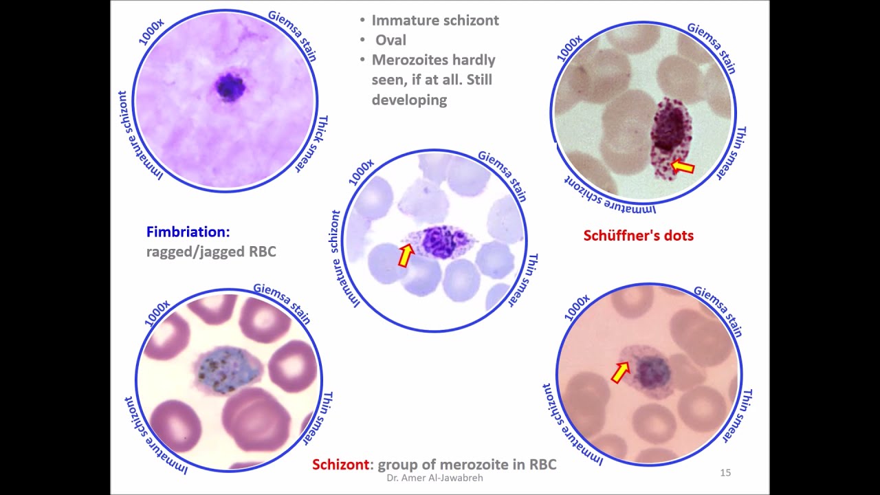 Malaria 4: Plasmodium ovale stages